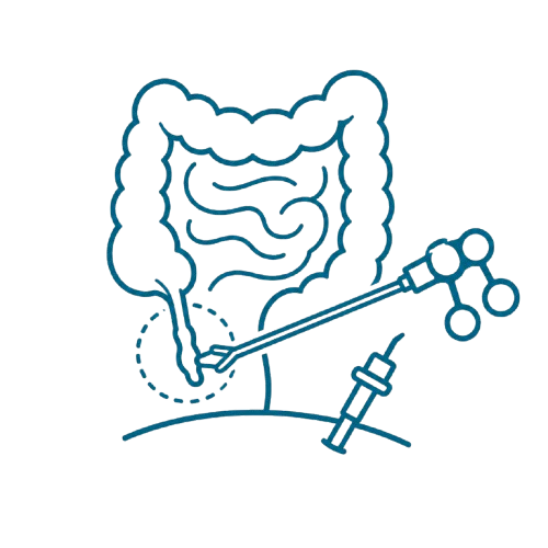 Appendix Surgery Icon